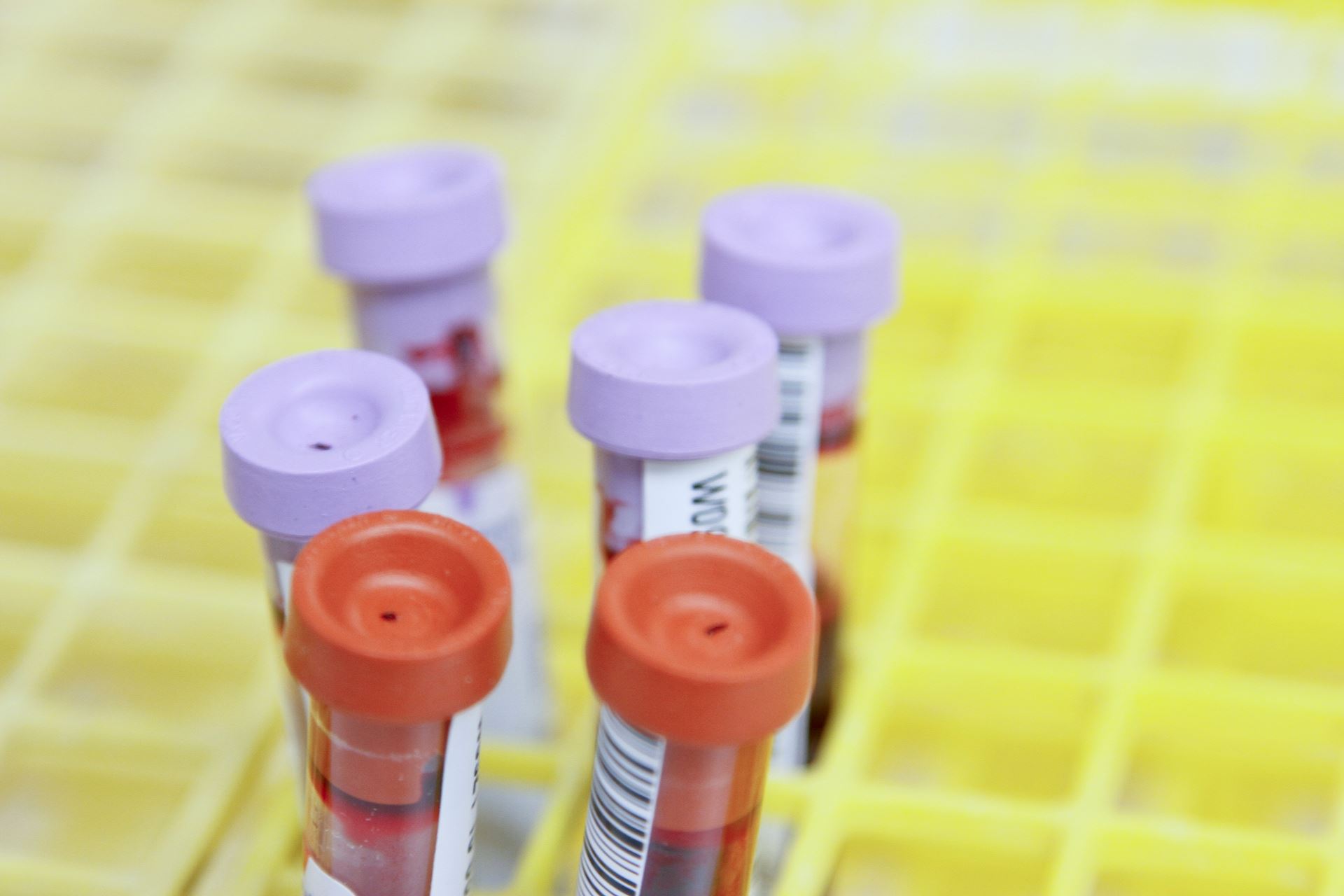 A selection of several blood test tubes