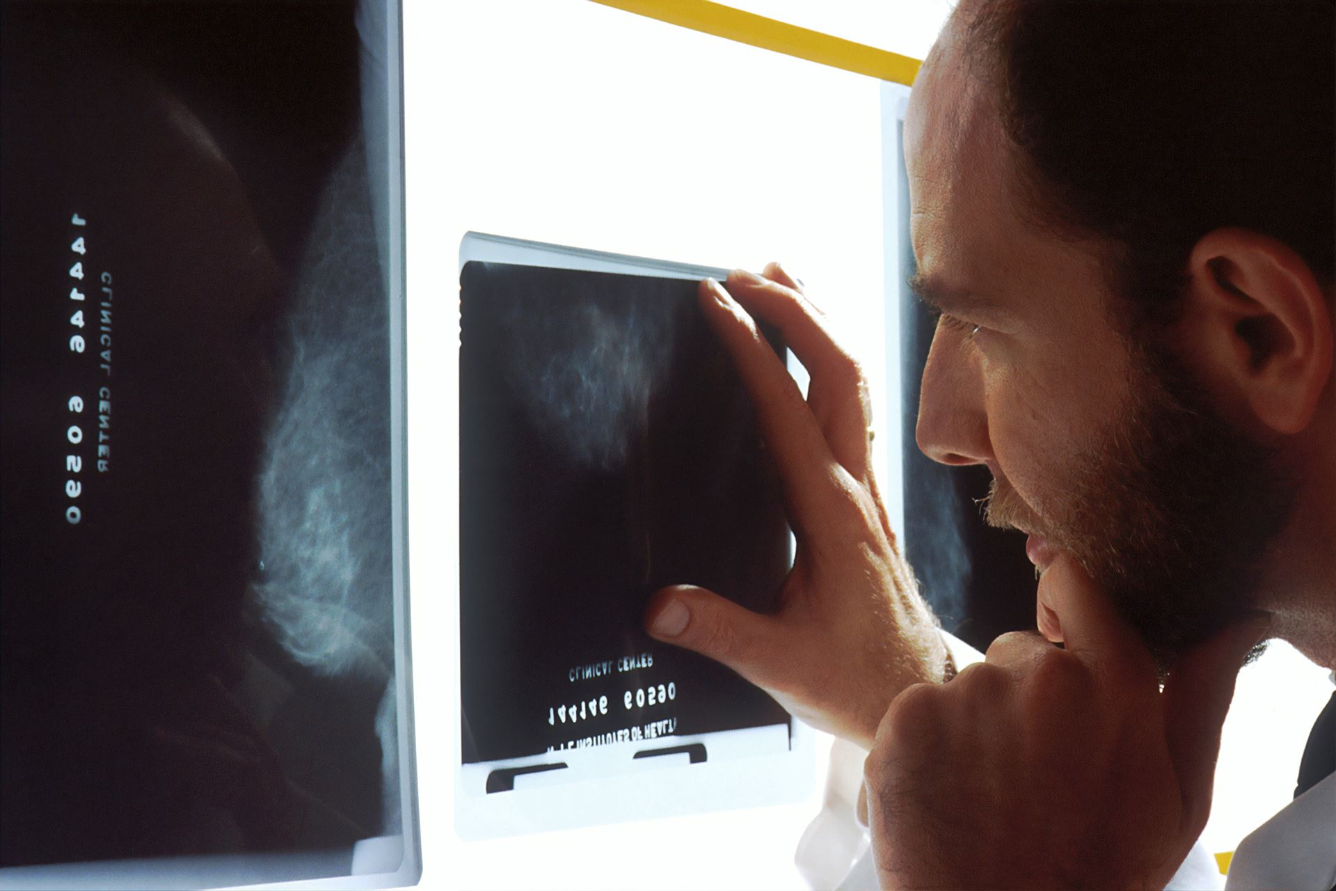 A person looking at an x-ray result again and light background